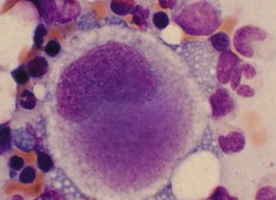 Ein Megakaryozyt bildet Blutplättchen.